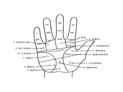 《掌纹与疾病》之掌丘