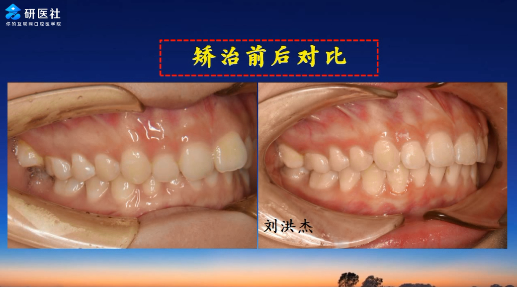 课 程 简 介 牙齿矫正是目前口腔领域的热门,有非常广阔的市场和不少
