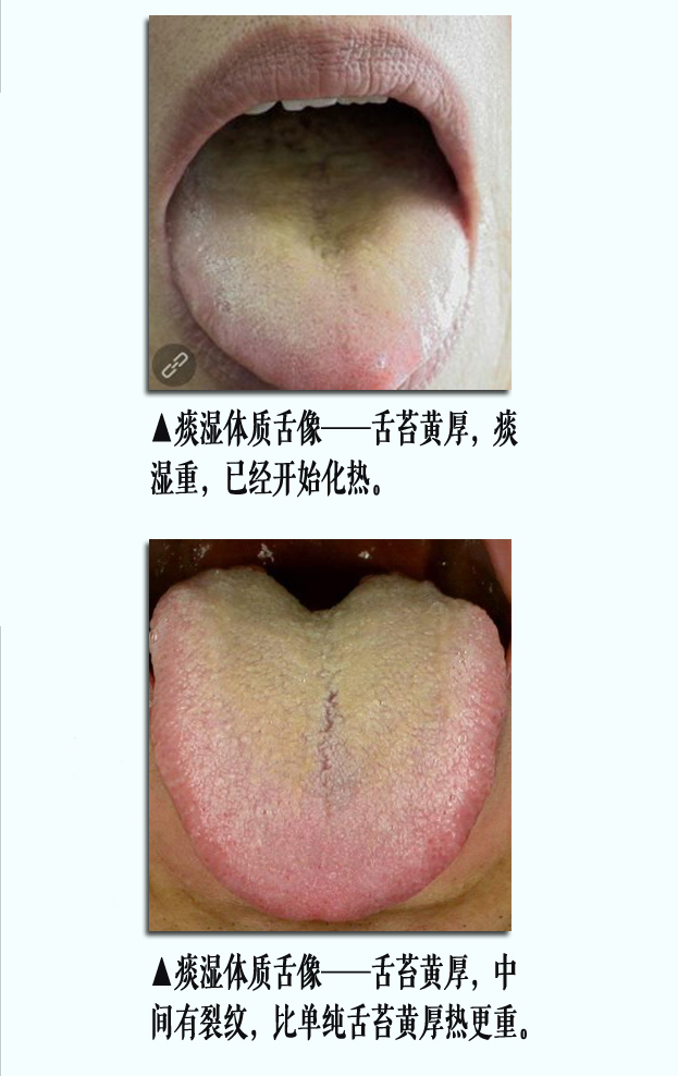 痰湿舌像2副本.jpg