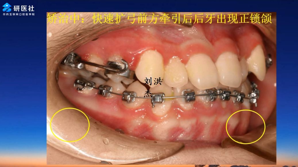 课 程 简 介 牙齿矫正是目前口腔领域的热门,有非常广阔的市场和不少
