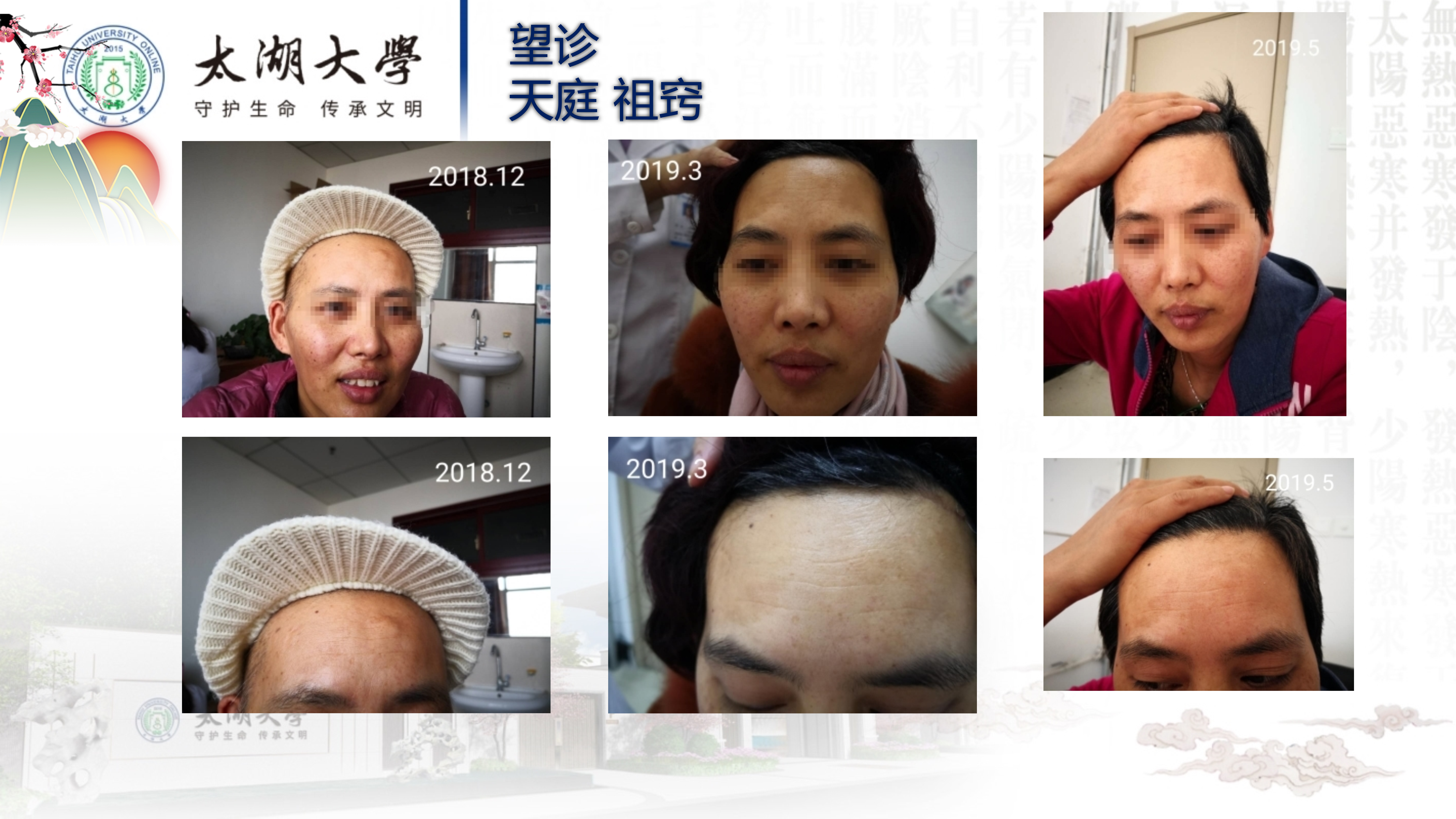 孙迎春讲座_25.jpg