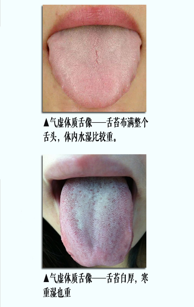 气虚舌像2副本.jpg