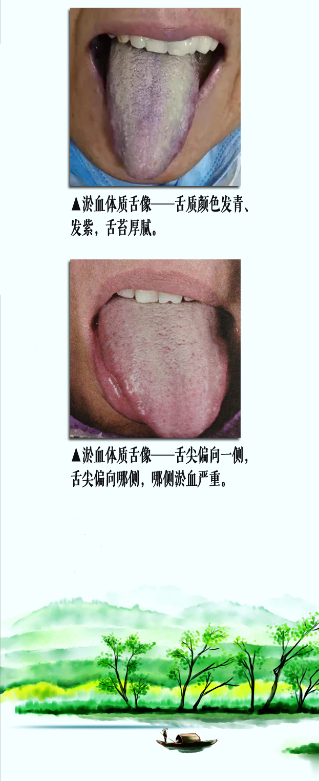淤血舌像2副本.jpg