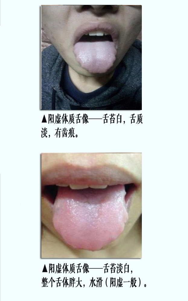 阳虚舌像1副本.jpg