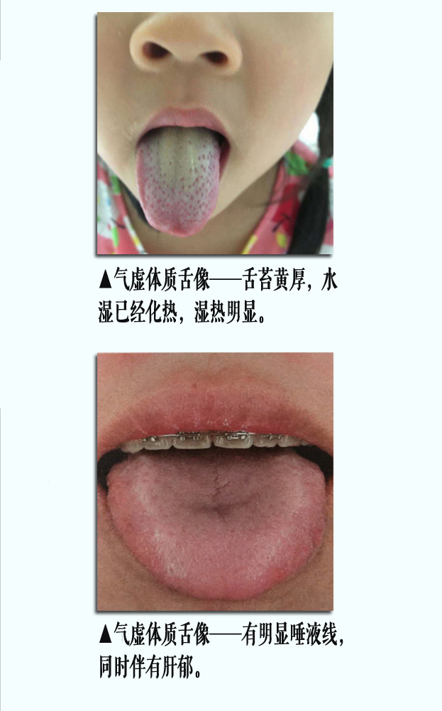 气虚舌像3副本.jpg