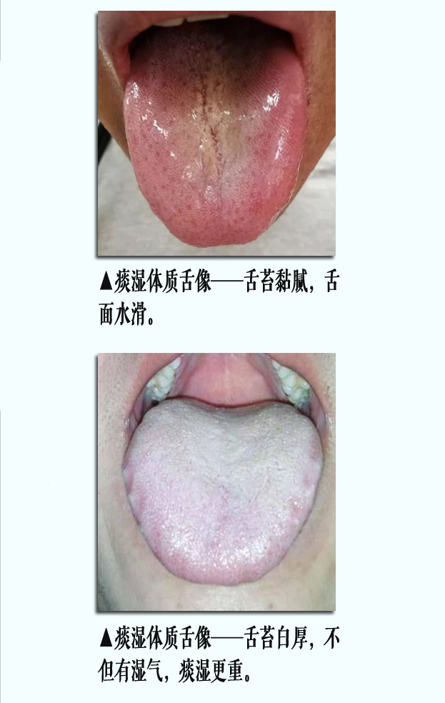 痰湿舌像1副本.jpg