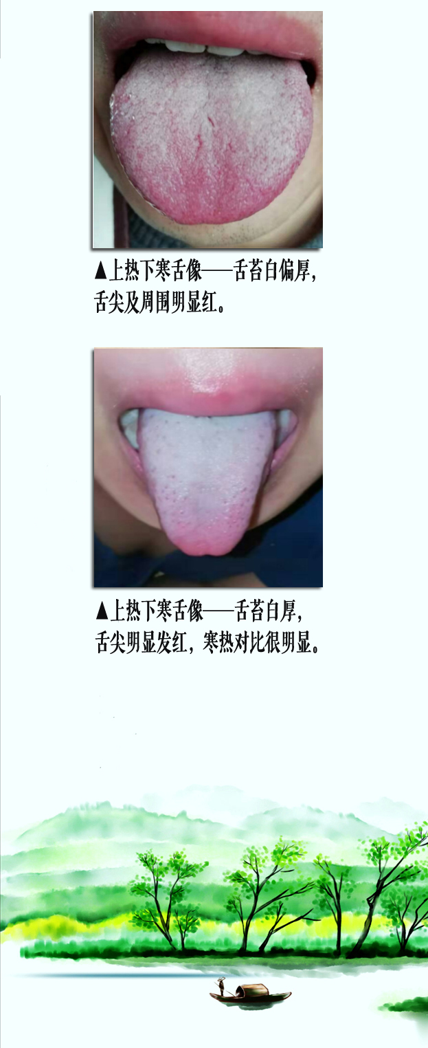 上热下寒舌像副本.jpg
