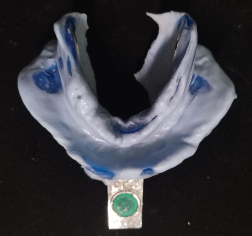 0系统之印模系列