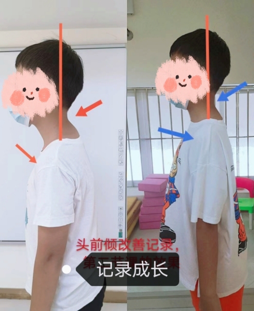 优雅体态训练营,告别驼背 头前倾 缓解肩颈疲劳