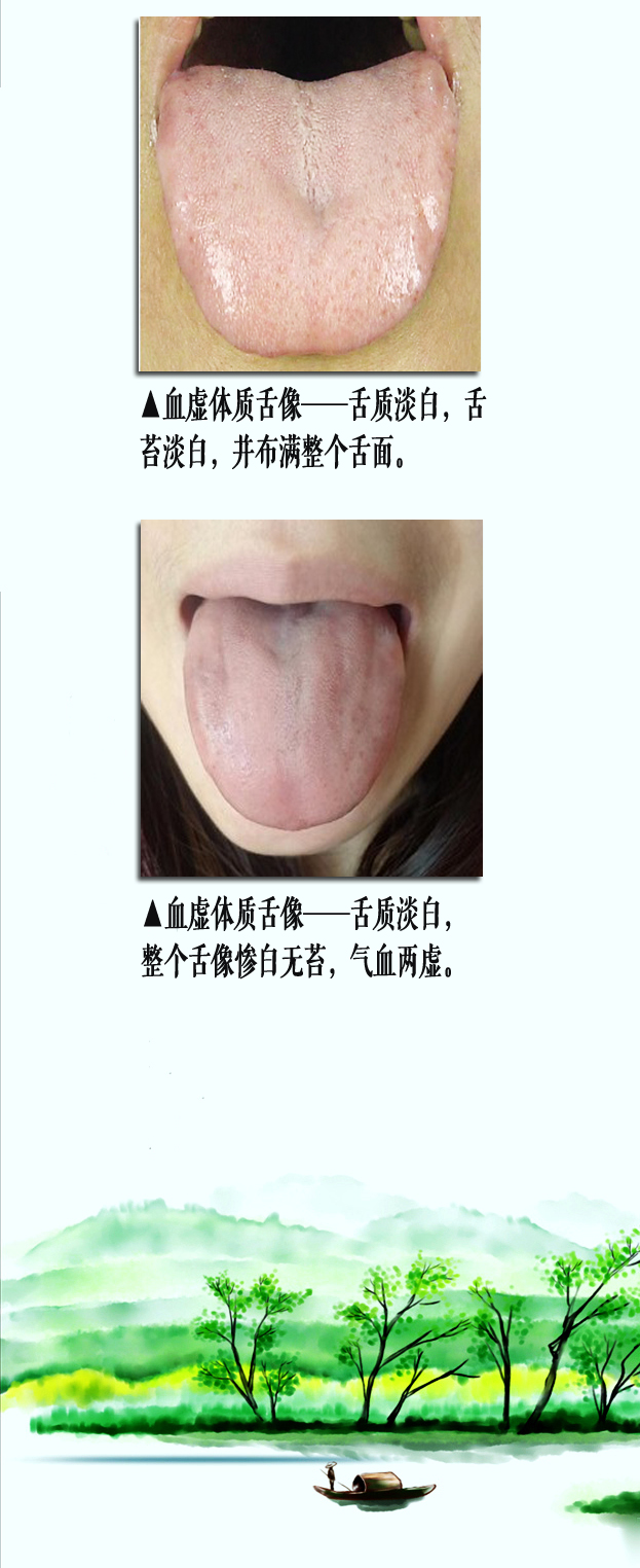 血虚舌像副本.jpg