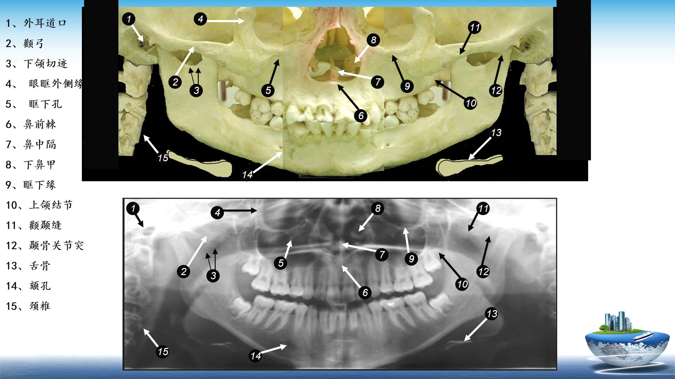 口腔全景片25个解剖点图片