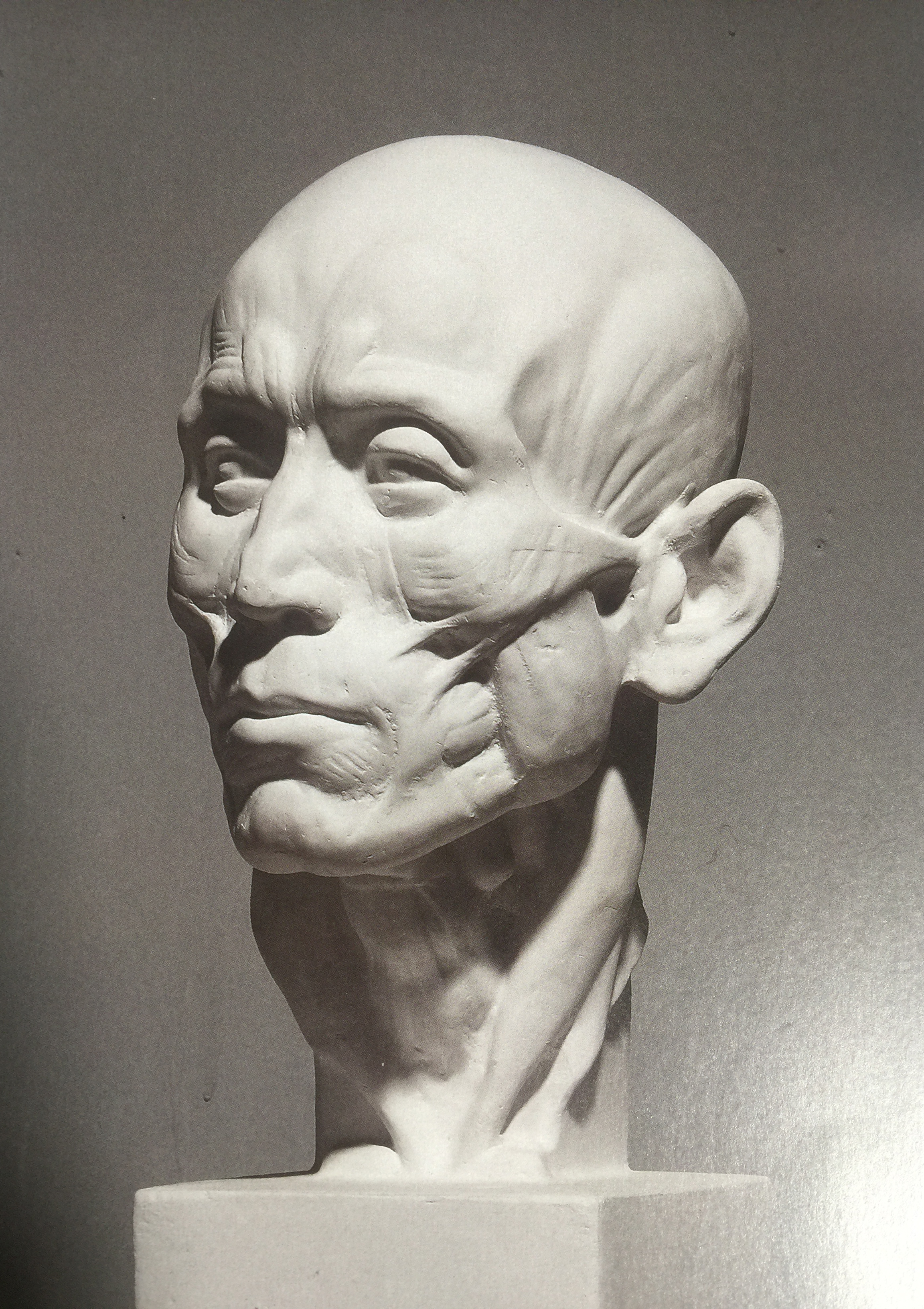 7-3:面部肌肉石膏上