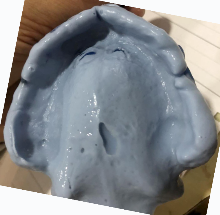 0系统之印模系列