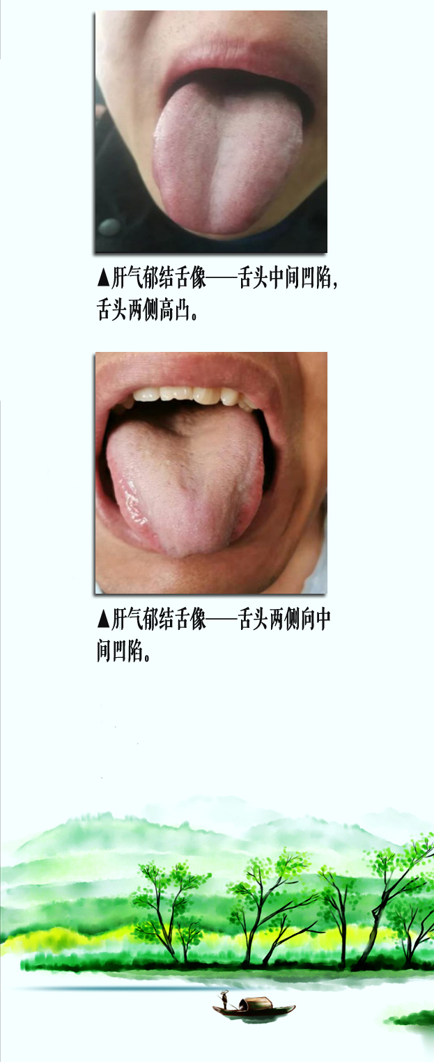 气郁舌像2副本.jpg