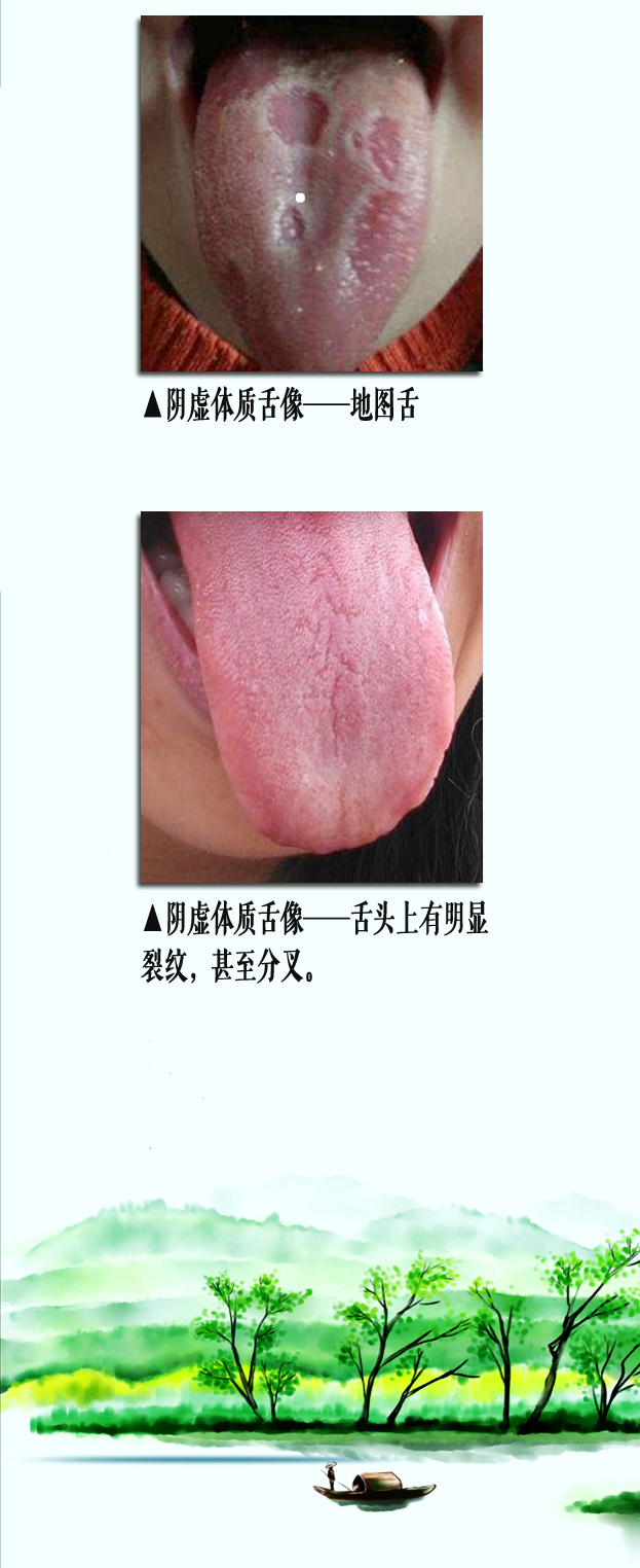 阴虚舌像2副本.jpg