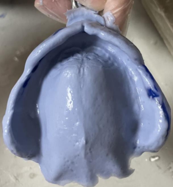 我们将全口义齿印模的精髓通通交给你,听了课再送你实操视频课程,临床