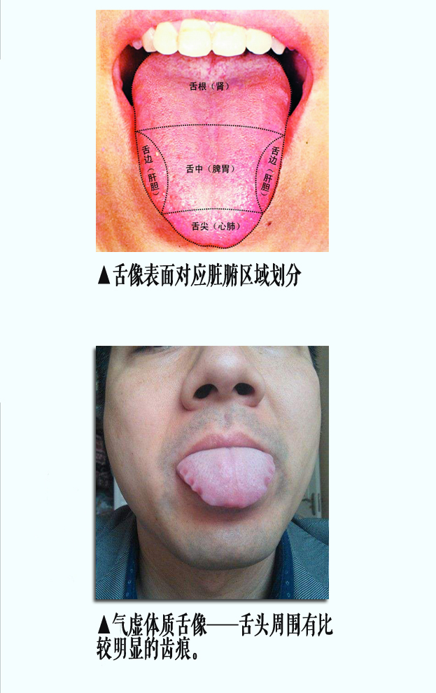 气虚舌像1副本.jpg