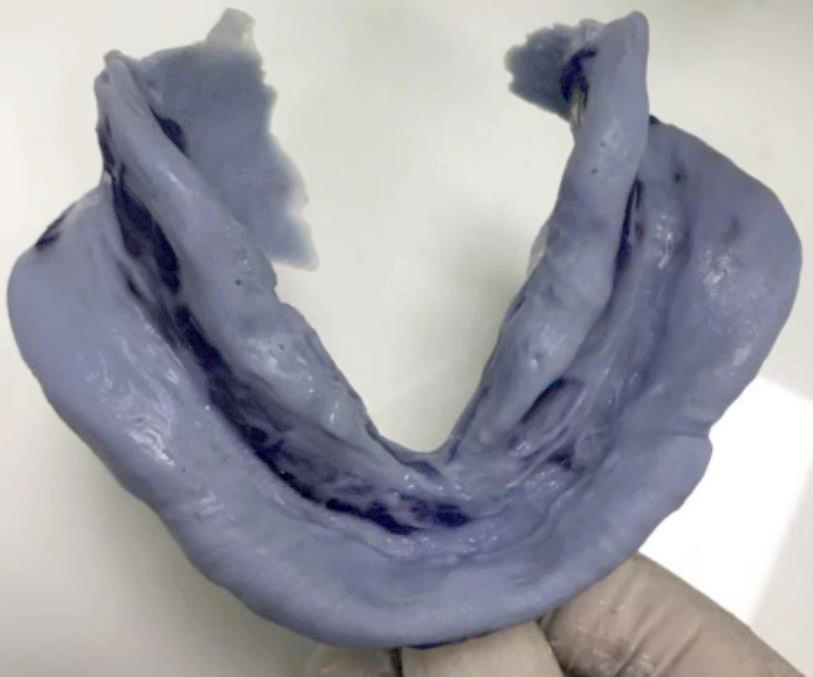 0系统之印模系列