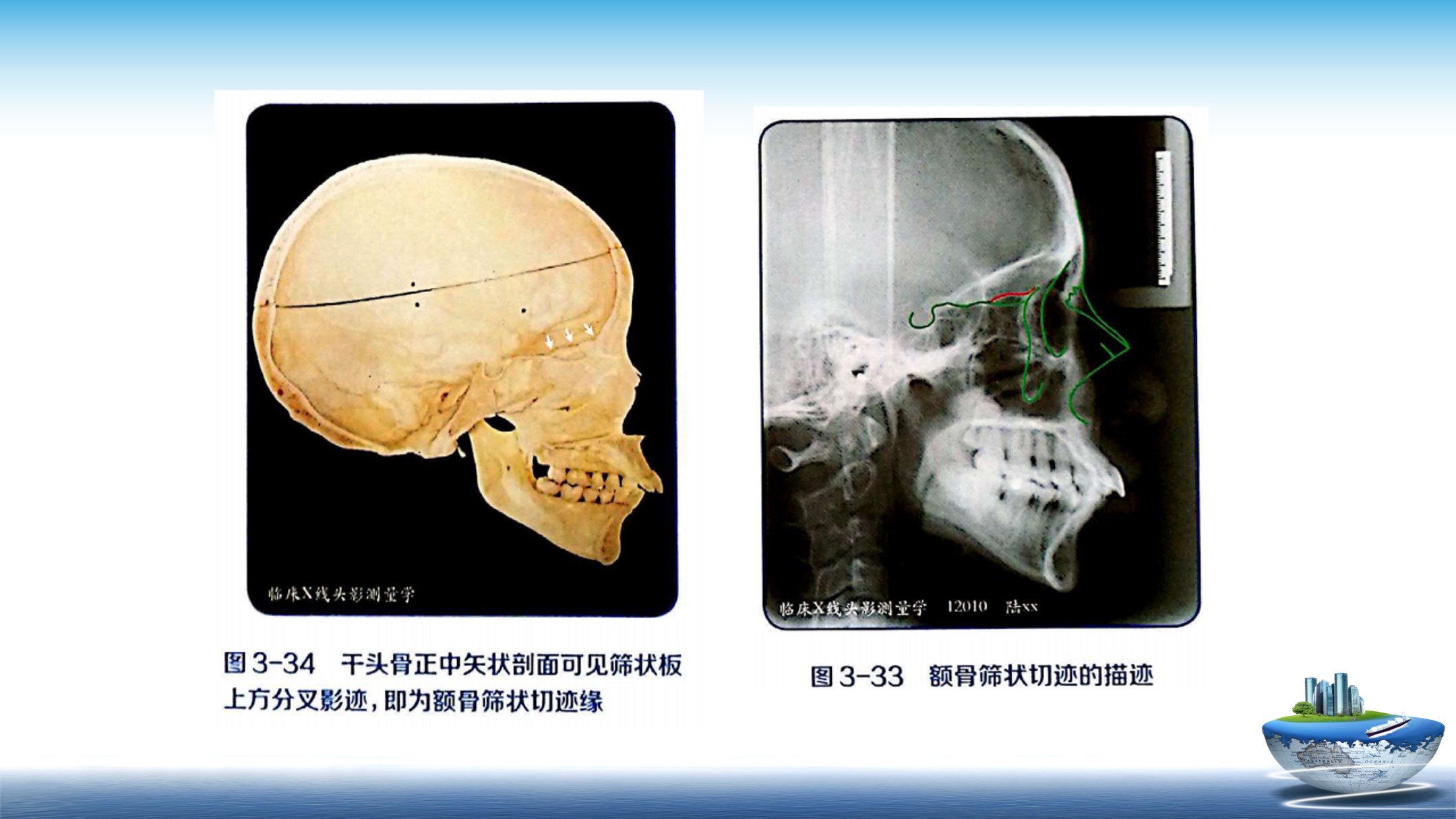 【刘汾 精品课】正畸需要了解的影像知识