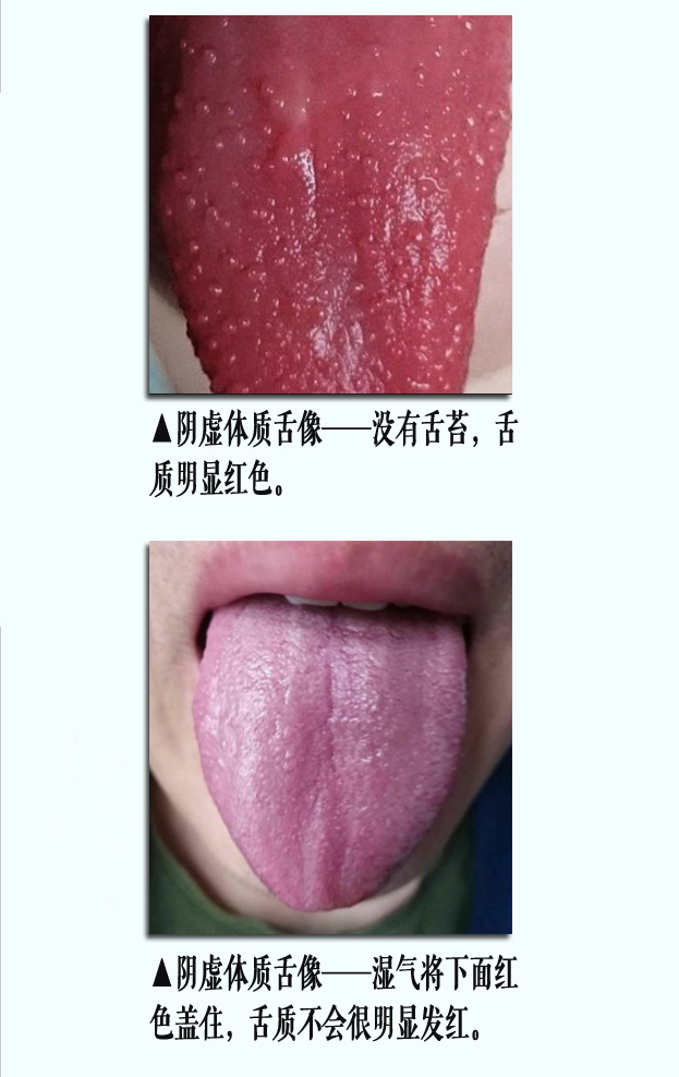 阴虚舌像1副本.jpg