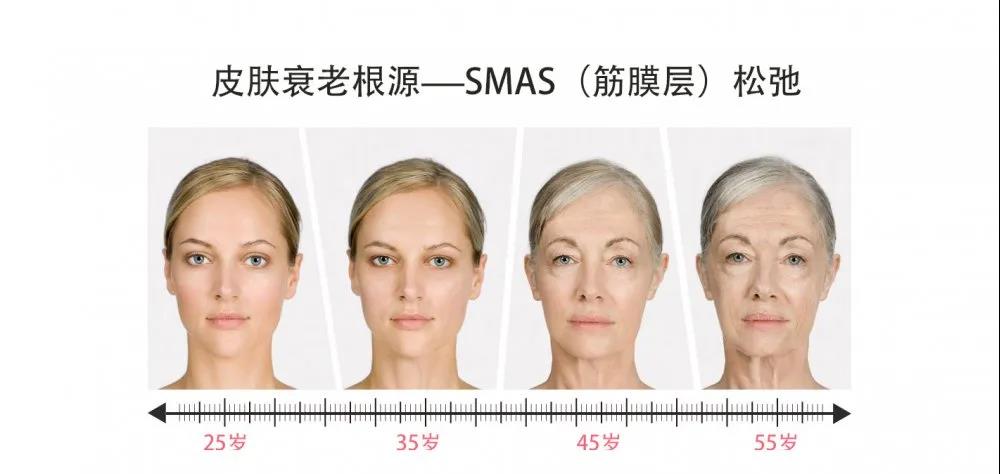 microson pen 童颜 年轻人的皮肤——筋膜韧带强韧,紧绷,有力的支撑
